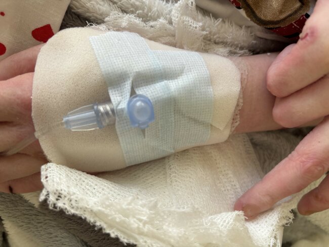 Fixace infuze EB Centrum